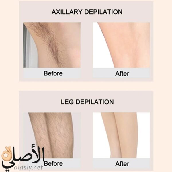 ⁦SK-17005 ماكينه سوكانى حريمى 3*1⁩ - الصورة ⁦11⁩