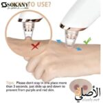 طريقة استخدام جهاز إزالة الرؤوس السوداء Sokany SK-319 لتنظيف البشرة بأمان