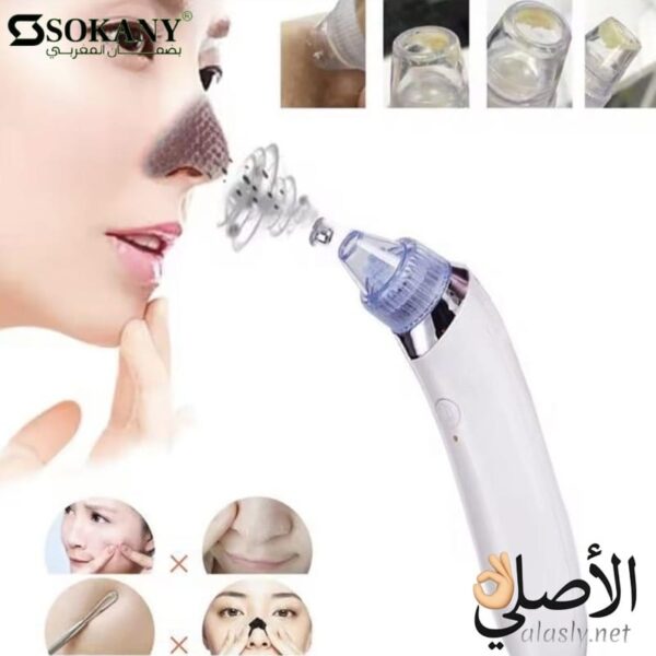 جهاز Sokany SK-319 مع 3 رؤوس شفط لتنظيف المسام وإزالة الدهون