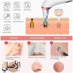 جهاز XN-8030 لتنظيف المسام وإزالة الرؤوس السوداء، USB قابل لإعادة الشحن، رؤوس متعددة الاستخدام