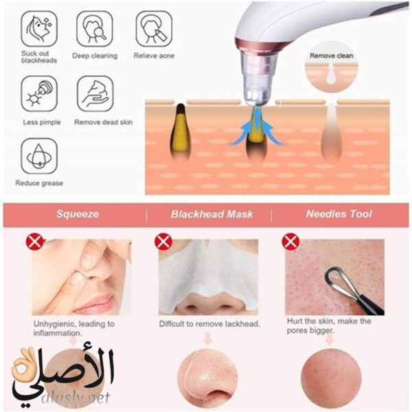 جهاز XN-8030 لتنظيف المسام وإزالة الرؤوس السوداء، USB قابل لإعادة الشحن، رؤوس متعددة الاستخدام
