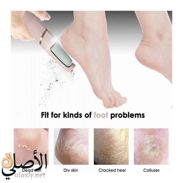 رأس طحن ناعم وخشن لإزالة الجلد الميت