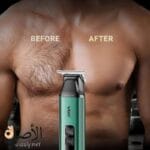 نتيجة استخدام ماكينة VGR قبل وبعد