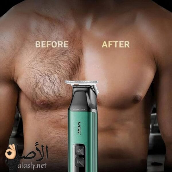 نتيجة استخدام ماكينة VGR قبل وبعد