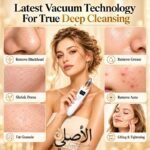 جهاز تنظيف مسام الوجه الكهربائي مع ثلاثة مستويات للشفط هي Soft وNormal وStrong لاختيار مستوى التشغيل.